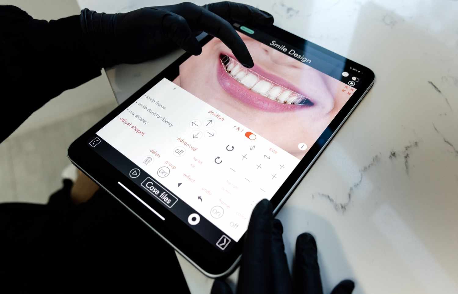 Digital smile design at Dental Haus